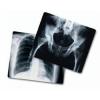Photo for Global X ray Film Market 2020 | Manufacturers, Regions, Type And Application, Forecast To 2025