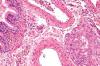 Photo for Pulmonologists Market 2020 Industry Growth, Shares, Opportunities and Forecast to 2023