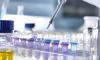 Photo for gemin5 antibody