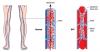 Photo for Global Fletcher Factor Assay Market Revenue to Record Stable Growth Through COVID-19 Affected Period