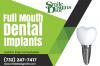 Photo for Full Mouth Dental Implant Treatment In Somerset, NJ