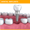 Photo for Dental clinic in thiruvalla