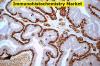 Photo for Immunohistochemistry Market: Huge Growth Opportunities, Trends And Forecast To 2027
