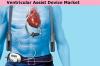 Photo for Ventricular Assist Device Market Business Analysis, Scope, Size, Trends, Demand, Overview, Forecast 2027