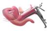Photo for New Research Colposcopy Market Detailed Analysis, Competitive landscape Forecast to 2028