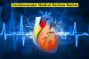Photo for Cardiovascular Medical Devices Market Business Analysis, Scope, Size, Trends, Demand, Overview, Forecast 2026