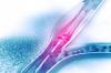Photo for Peripheral Vascular Devices Market: Minimally Invasive Surgeries are Driving the Growth