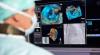 Photo for Global Medical Image Analysis Software Market 2020 | Manufacturers Regions Type And Application Forecast To 2025