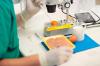 Photo for campylobacter testing in food