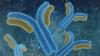 Photo for Alzheimer Disease gene therapy