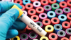 Photo for Global HPV Testing and Pap Test Market Research Report - Industry Analysis, Size, Share, Growth, Trends and Forecast Till 2026