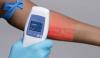Photo for Global Vein Illumination Devices Market Research Report - Industry Analysis, Size, Share, Growth, Trends and Forecast Till 2026