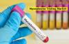 Photo for Mycoplasma Testing Market Business Analysis, Scope, Size, Trends, Demand, Overview, Forecast 2027