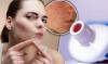 Photo for Global Fast Treatment Market Share, Trend & Analysis 2020 - 2024