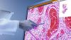 Photo for Global Digital Pathology Market Research Report - Industry Analysis, Size, Share, Growth, Trends and Forecast Till 2026