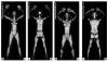 Photo for Global Full Body Scanner Market 2020 | Manufacturers Regions Type And Application Forecast To 2025