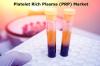 Photo for Platelet Rich Plasma (PRP) Market Demands, Types, Projected Industry Size & Shares 2028