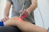 Photo for Global Physical Therapy Laser Laser Market 2020 | Manufacturers, Regions, Type And Application, Forecast To 2025