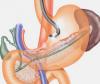 Photo for Global Gastrointestinal Electrocardiograph Market Research Report - Industry Analysis, Size, Share, Growth, Trends and Forecast Till 2026