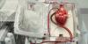 Photo for Global Organ Preservation Market Research Report - Industry Analysis, Size, Share, Growth, Trends and Forecast Till 2026