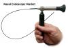 Photo for Nasal Endoscope Market : Current Trends, Future Demand, Market Analysis & Outlook To 2023
