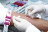 Photo for Global Bleeding Disorders Treatment Market Research Report - Industry Analysis, Size, Share, Growth, Trends and Forecast Till 2026