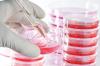 Photo for Global Cell Culture Media Market Research Report - Industry Analysis, Size, Share, Growth, Trends and Forecast Till 2026