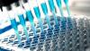 Photo for Global ELISA Market Research Report - Industry Analysis, Size, Share, Growth, Trends and Forecast Till 2026