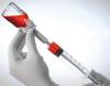 Photo for Global Bendamustine Injection Market 2020 | Manufacturers, Regions, Type And Application, Forecast To 2025