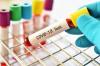 Photo for Global 2019-nCoV Detection Server Market 2020 | Manufacturers, Regions, Type And Application, Forecast To 2025