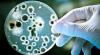 Photo for campylobacter testing in food
