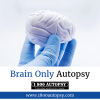 Photo for Brain Only Autopsy