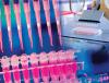 Photo for Global Autoimmunity Immunoassay Market Research Report - Industry Analysis, Size, Share, Growth, Trends and Forecast Till 2026