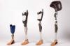 Photo for Global Artificial Limbs Market 2020 | Manufacturers Regions Type And Application Forecast To 2025