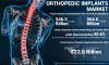 Photo for Orthopedic Implants Market - What will be the Short-term Impact of Coronavirus?