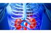 Photo for Global Transplant Diagnostics Market Research Report - Industry Analysis, Size, Share, Growth, Trends and Forecast Till 2026