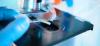 Photo for Global Infectious Disease Diagnostics Testing Market 2020 | Manufacturers, Regions, Type And Application, Forecast To 2025
