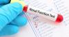 Photo for Global Renal Function Test Market 2020 | Manufacturers, Regions, Type And Application, Forecast To 2025