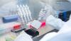 Photo for Global Immunoprecipitation Market: Increasing Focus on Biomarker Discovery and Increasing Number of Life Sciences Research Activities
