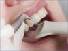 Photo for Global Dental Consumables Market Research Report - Industry Analysis, Size, Share, Growth, Trends and Forecast Till 2026