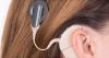 Photo for Global Cochlear Implants Market Research Report - Industry Analysis, Size, Share, Growth, Trends and Forecast Till 2026
