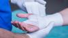 Photo for Global Wound Dressings Market Research Report - Industry Analysis, Size, Share, Growth, Trends and Forecast Till 2026