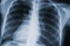 Photo for Global X-Ray Imaging Market Research Report - Industry Analysis, Size, Share, Growth, Trends and Forecast Till 2026