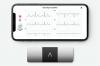 Photo for Global ECG Devices Market Research Report - Industry Analysis, Size, Share, Growth, Trends and Forecast Till 2026
