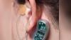 Photo for Global Neurostimulation Devices Market Research Report - Industry Analysis, Size, Share, Growth, Trends and Forecast Till 2026