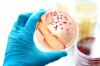 Photo for Global HDAC Inhibitors Market Research Report - Industry Analysis, Size, Share, Growth, Trends and Forecast Till 2026