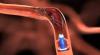 Photo for Neurothrombectomy Devices Market Report Application and Regional Growth Forecast Till 2025