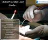 Photo for Comprehensive Report On Global Vascular Graft Market By Knowledge Sourcing Intelligence