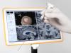 Photo for Global Intra-Operative 3D Navigation System Market Research Report - Industry Analysis, Size, Share, Growth, Trends and Forecast Till 2026