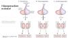 Photo for Global Male Hypogonadism Market Forecast 2025